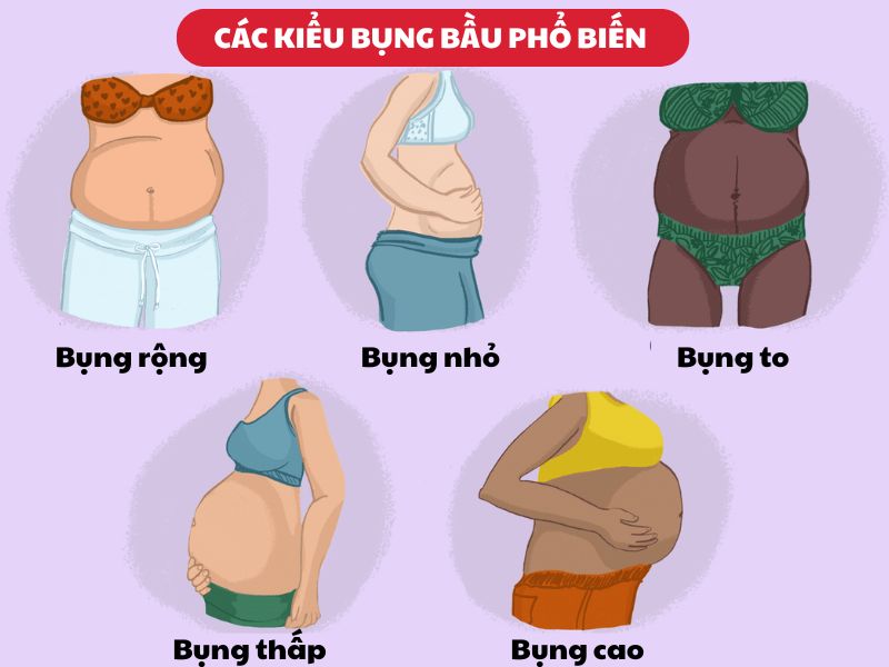 các kiểu bụng bầu phổ biến