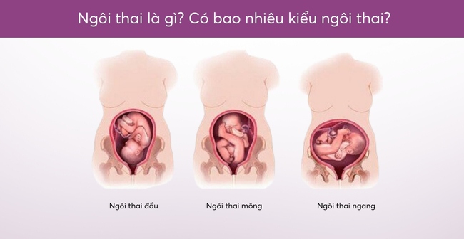 Ngôi thai là gì? Có bao nhiêu kiểu ngôi thai?