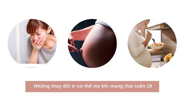 Mẹ bầu 19 tuần có hiện tượng buồn nôn, rốn bắt đầu lồi ra, thèm ăn những thứ lạ,.